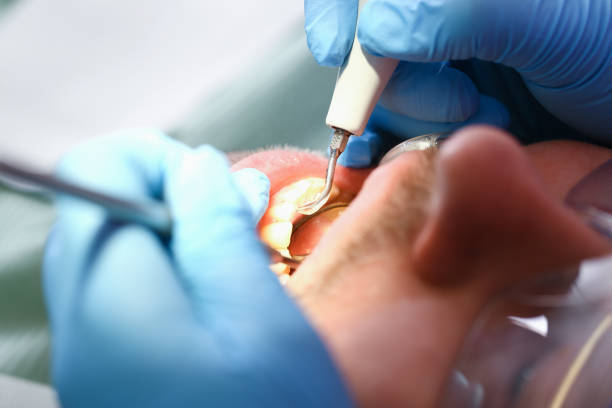 Best Emergency Broken Tooth Repair in Ecru, MS