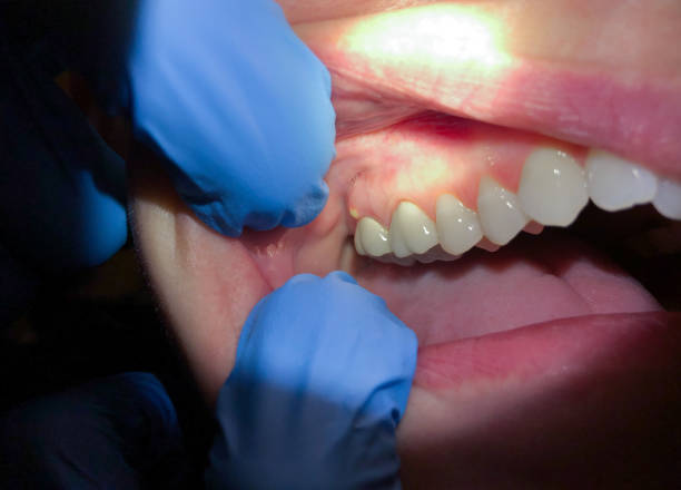 Best Emergency Treatment for Toothache in Ecru, MS
